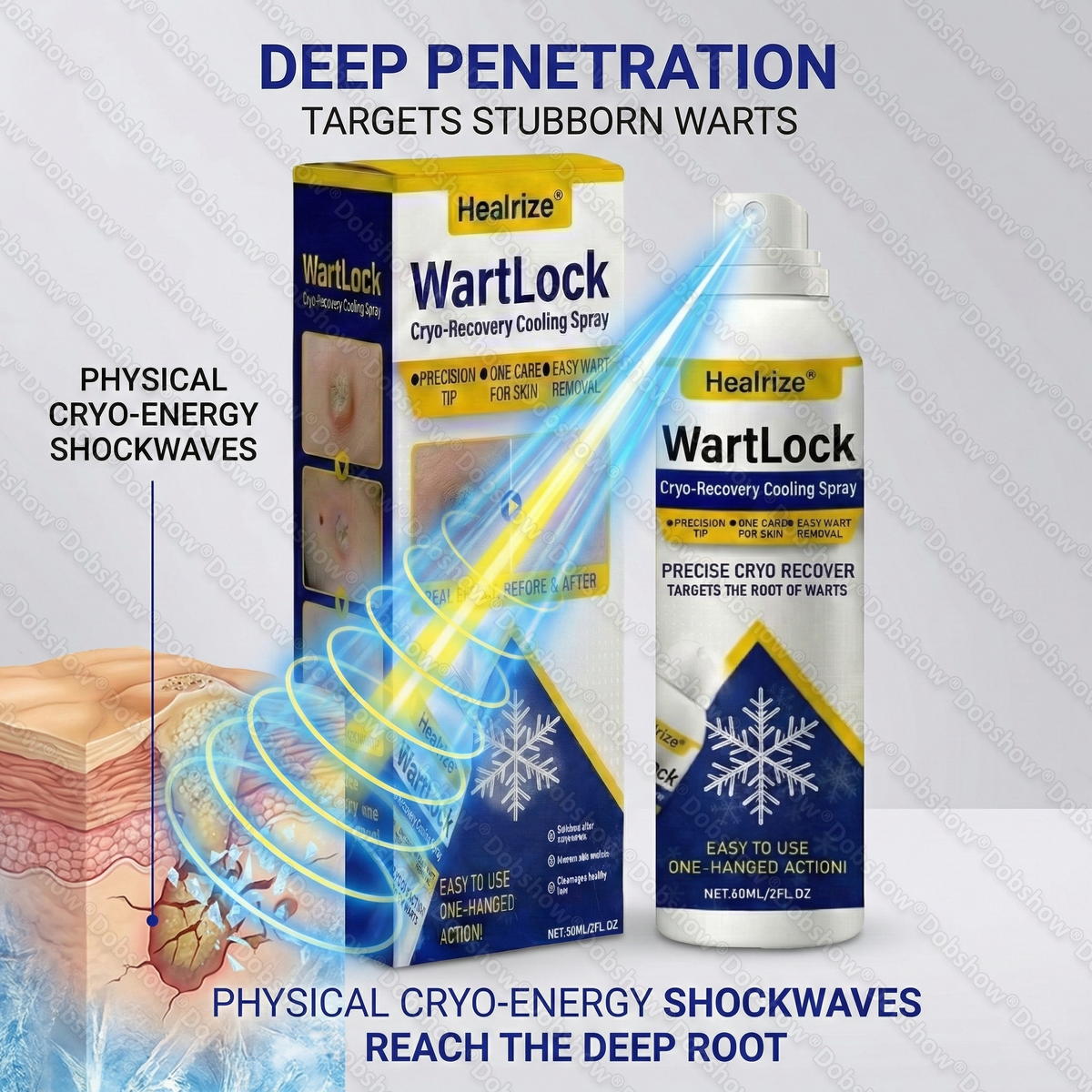 🔥𝙎𝙥𝙚𝙘𝙞𝙖𝙡 𝙊𝙛𝙛𝙚𝙧 | Healrize® WartLock Cryo-Recovery Cooling Spray