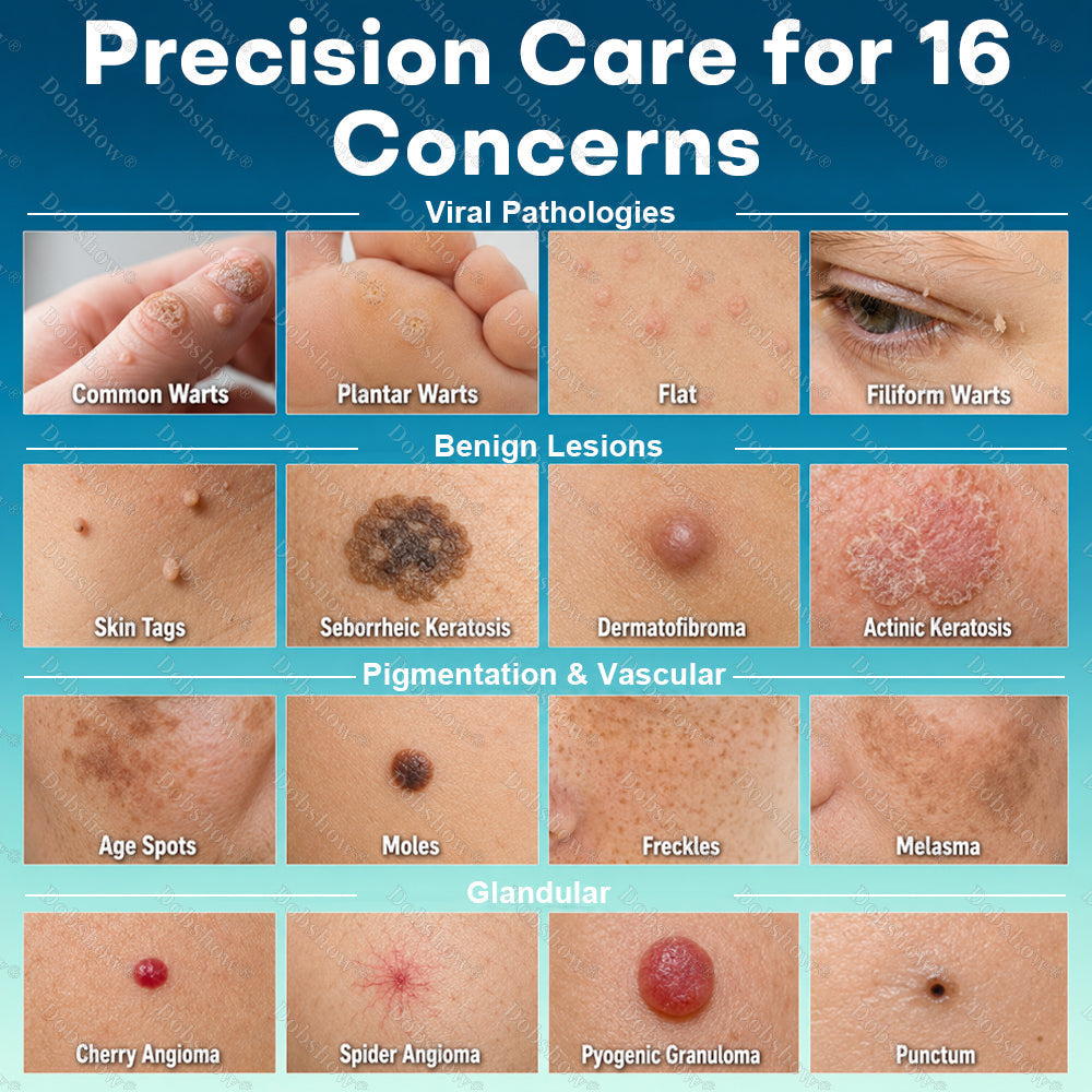 Healrize® Precision Wart & Blemish Care Roll-On Pen