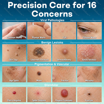 Healrize® Precision Wart & Blemish Care Roll-On Pen