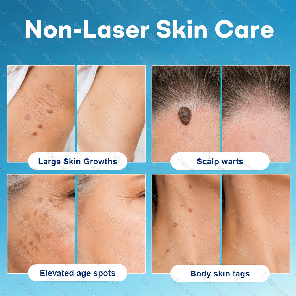 Healrize® Precision Wart & Blemish Care Roll-On Pen