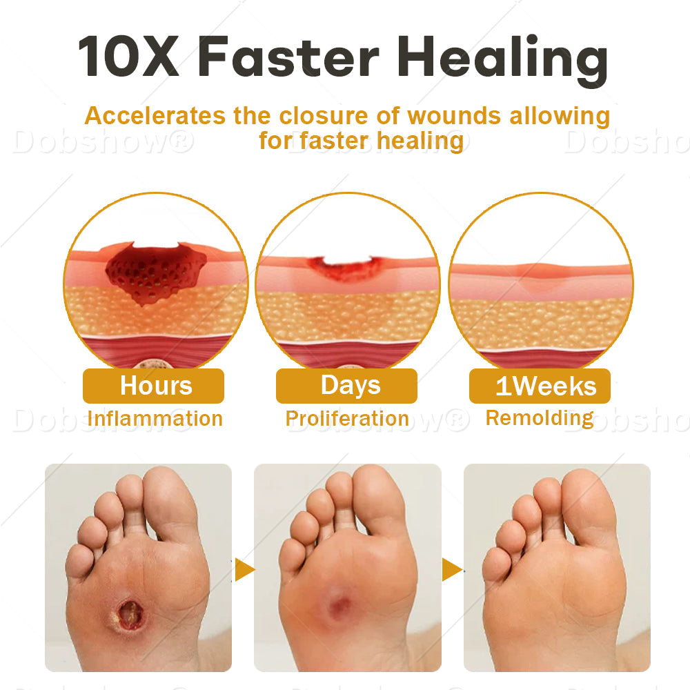 Healrize®GlucoShield Wound Spray💥
