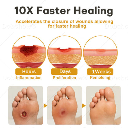 Healrize®GlucoShield Wound Spray💥