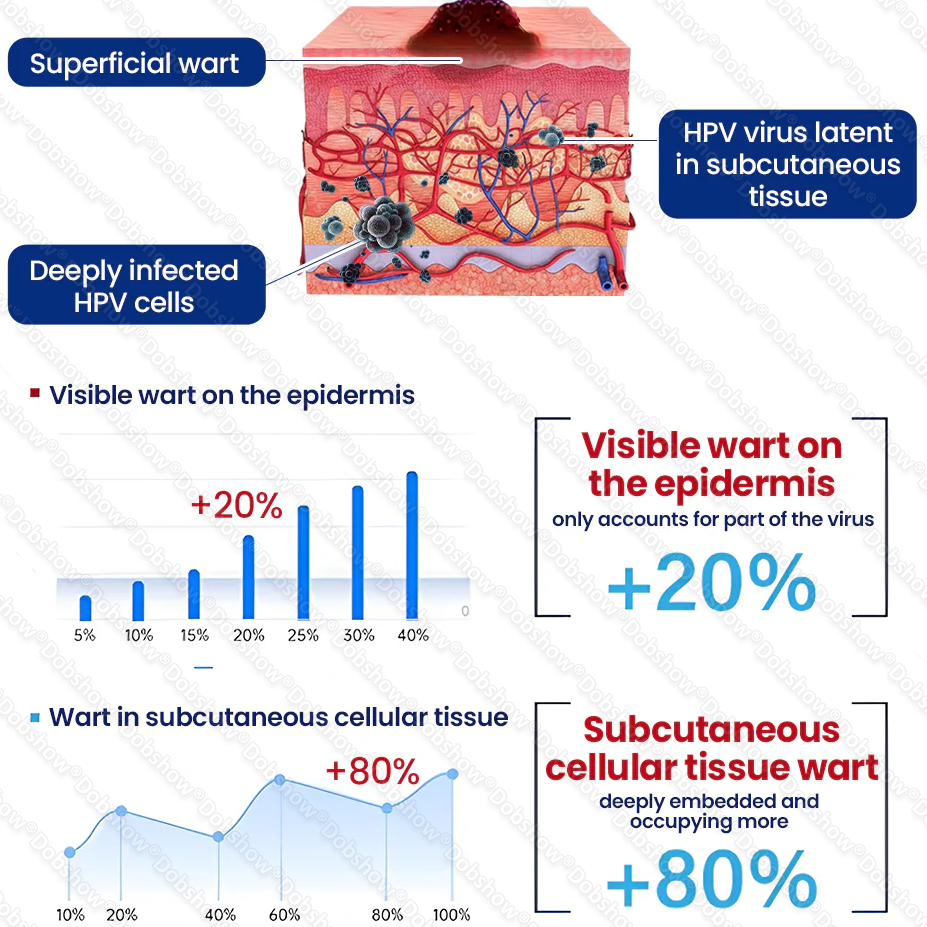 🔥𝙎𝙥𝙚𝙘𝙞𝙖𝙡 𝙊𝙛𝙛𝙚𝙧 | Healrize® WartLock Cryo-Recovery Cooling Spray