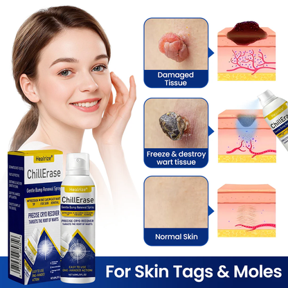 ❄️✅Healrize®ChillErase Gentle Bump Renewal Spray — Pain-Free, Acid-Free Gentle Wart Removal