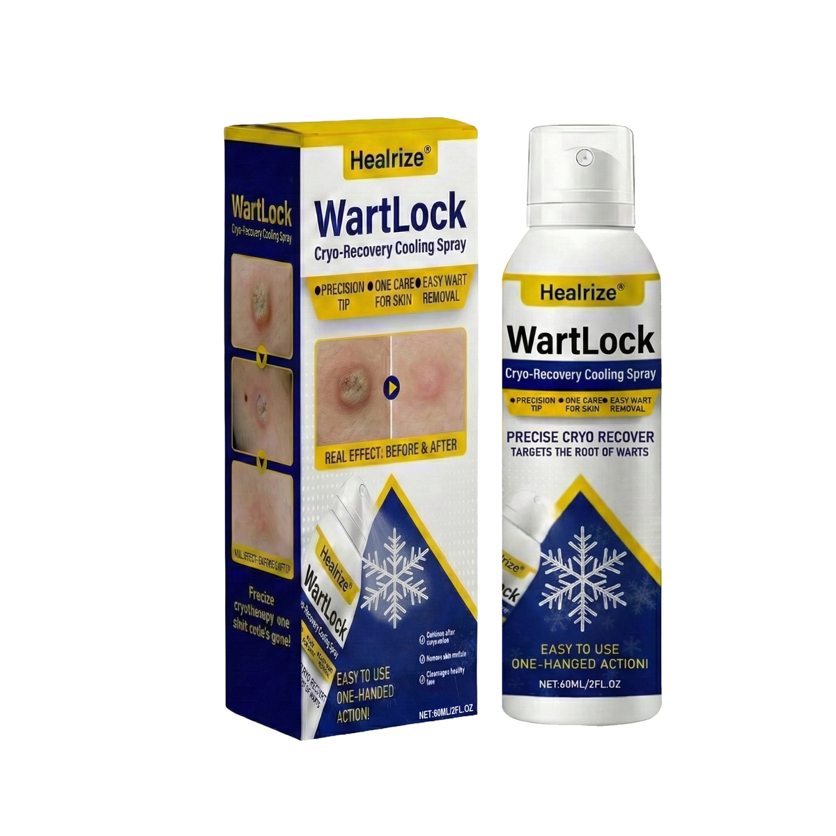 🔥𝙎𝙥𝙚𝙘𝙞𝙖𝙡 𝙊𝙛𝙛𝙚𝙧 | Healrize® WartLock Cryo-Recovery Cooling Spray