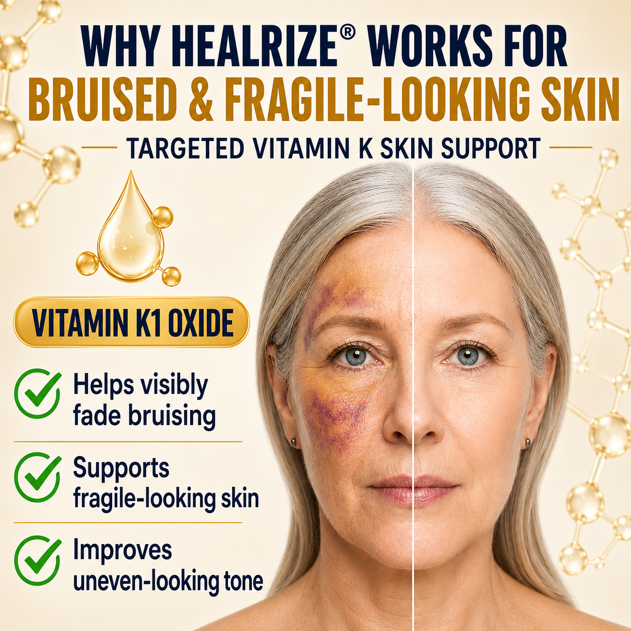 𝐇𝐞𝐚𝐥𝐫𝐢𝐳𝐞® Premium Vitamin K Bruise Repair Cream