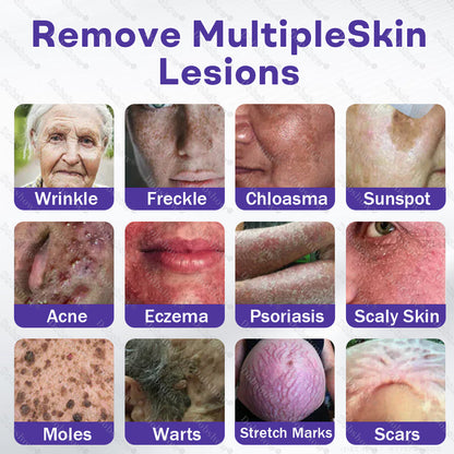 Dobshow® Wart and mole removal microneedle patch