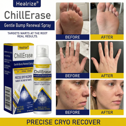 ❄️✅Healrize®ChillErase Gentle Bump Renewal Spray — Pain-Free, Acid-Free Gentle Wart Removal