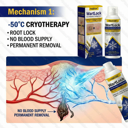 🔥𝙎𝙥𝙚𝙘𝙞𝙖𝙡 𝙊𝙛𝙛𝙚𝙧 | Healrize® WartLock Cryo-Recovery Cooling Spray