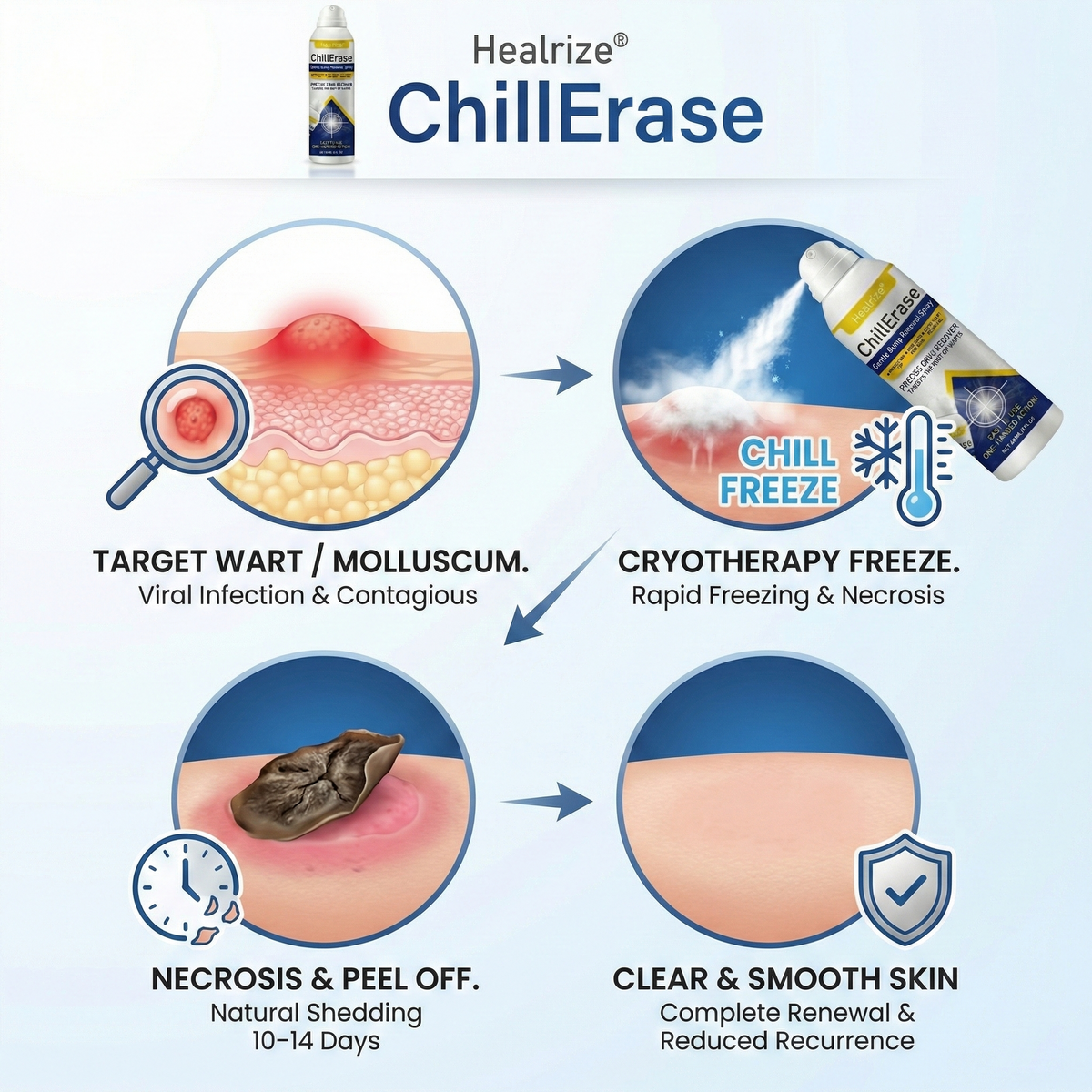 ❄️✅Healrize®ChillErase Gentle Bump Renewal Spray — Pain-Free, Acid-Free Gentle Wart Removal